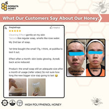 Load image into Gallery viewer, The Skin (Acne/Eczema) Package